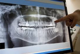 Teeth Pano Dental Image Digital - Eden Prairie Chanhassen Dentist Minnesota - Dr. Chi & Dr. Derr Family Dentistry